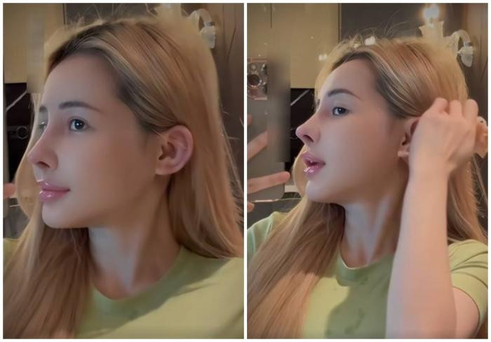 Ngân 98: Tôi hối hận với quyết định sửa mũi lần này, mọi thứ quá tồi tệ