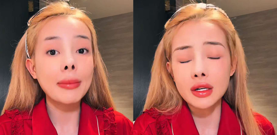 Ngân 98 tiếp tục sửa mũi sau 10 lần PTTM, công khai giá khiến ai cũng bất ngỡ: Chiếc mũi bé tí mà giá trị gần bằng con ô tô