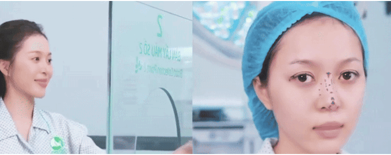 Một Hoa hậu Việt Nam công khai PTTM  trước thềm chinh chiến tại cuộc thi Hoa hậu Quốc tế, netizen phản ứng d:ữ d:ội: “Đi thi Hoa hậu mà mặt s:ửa gần như không còn nét thật thì thi cái gì nữa?”