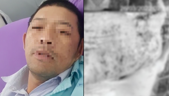Người tố C.P bị cắt BHYT, phải tự lo tiền chạy th:ận: “Sức khỏe tôi tự gánh được, miễn người khác không ăn phải th:ịt b:ệnh là được!
