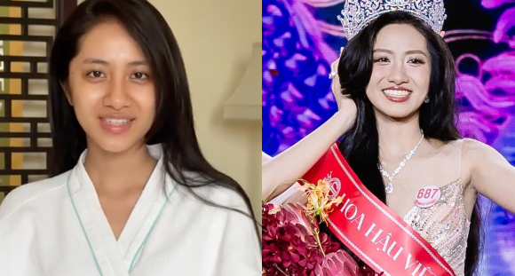 Nhan sắc Tân Hoa hậu Việt Nam gây tr:anh c:ãi d:ữ d:ội: Netizen réo tên bác sĩ thẩm mỹ, yêu cầu “nâng cấp” cho xứng vương miện!