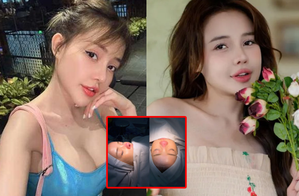 Ngân 98 nh:ập viện vì bi:ến ch:ứng n:ặng sau 11 lần d:ao k:éo: Bác sĩ tiên lượng x:ấu, phải theo dõi mỗi ngày!