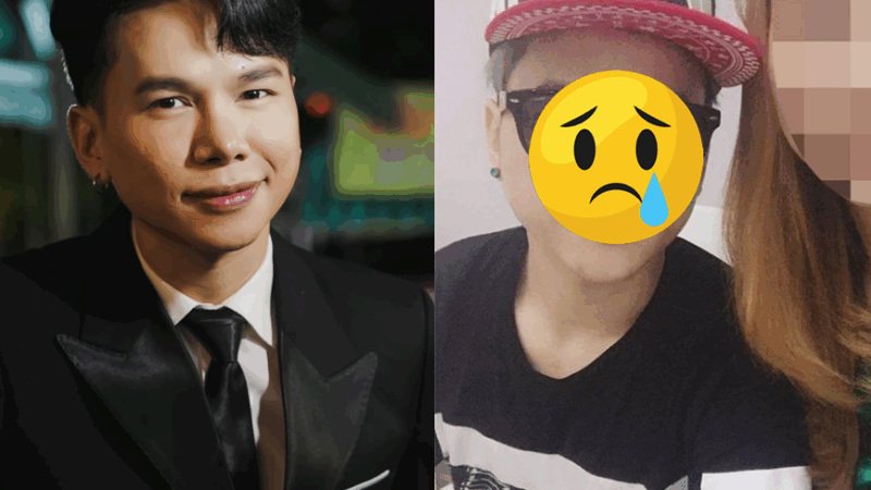 Nam ca sĩ Việt mặt bi:ến d:ạng vì thẩm mỹ h:ỏng, tr:ốn biệt không dám gặp ai: ‘Muốn đẹp mà thành ra th:ảm h:oạ’”
