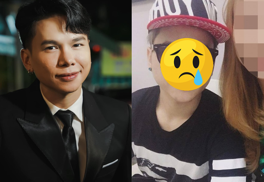Nam ca sĩ Việt mặt bi:ến d:ạng vì thẩm mỹ h:ỏng, tr:ốn biệt không dám gặp ai: ‘Muốn đẹp mà thành ra th:ảm h:oạ’”