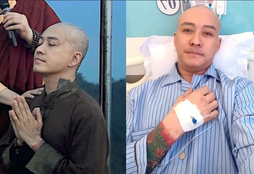 Tuấn Hưng nhập viện ph:ẫu thu:ật sau thời gian đi t:u: Tình trạng hiện tại khiến fan lo sốt vó!
