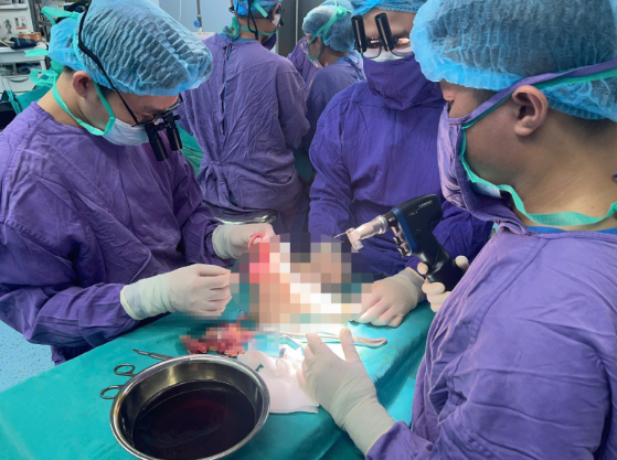 Bác sĩ Việt Nam khiến dân mạng nể phục: Nối thành công chân bị đứt lìa cho cô gái gặp nạn mô tô phân khối lớn – điều kỳ diệu đã xảy ra!