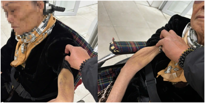 Vụ nữ giúp việc bạ:o hà:nh cụ bà 82 tuổi: Gia đình choá:ng với kết quả giám định thương tật của nạ:n nh:ân, sao lại ra nông nổi thế này